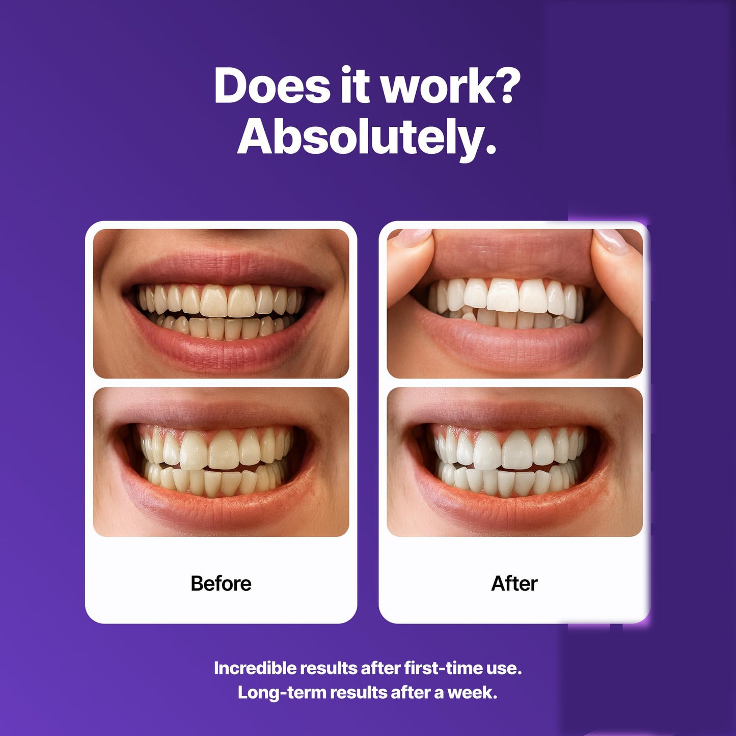 Teeth Whitening Strips