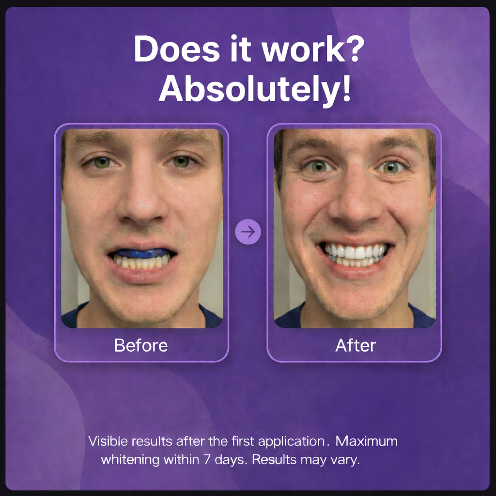 Teeth Whitening Strips